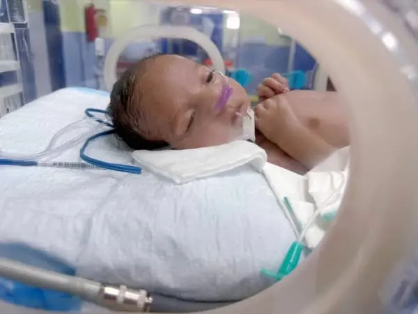 Patient Story – SICHN Unit, SBA-event-img